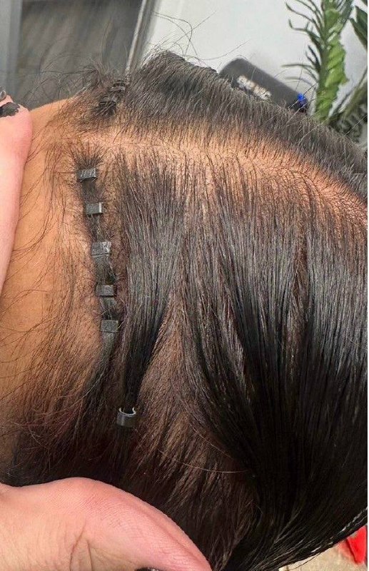 Before — thinning with integration clips