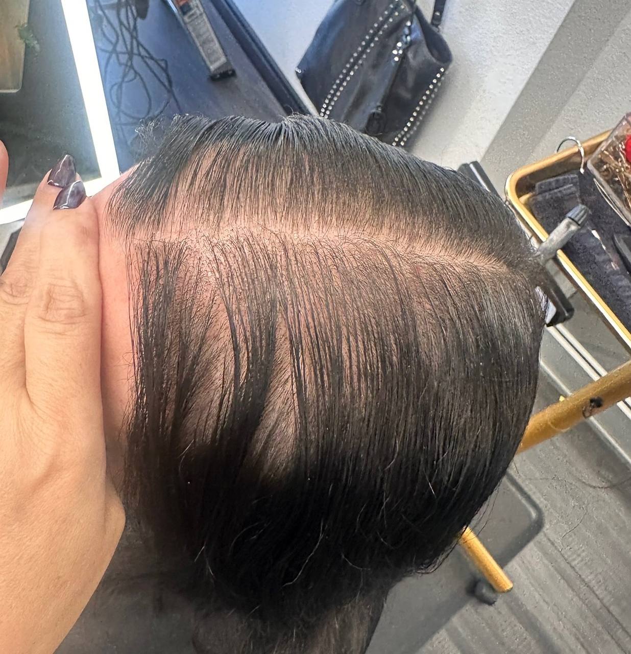 Before — dark hair with thinning visible at the part