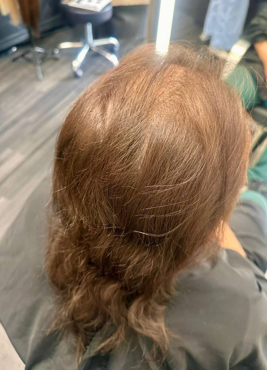 Before — auburn hair with crown thinning