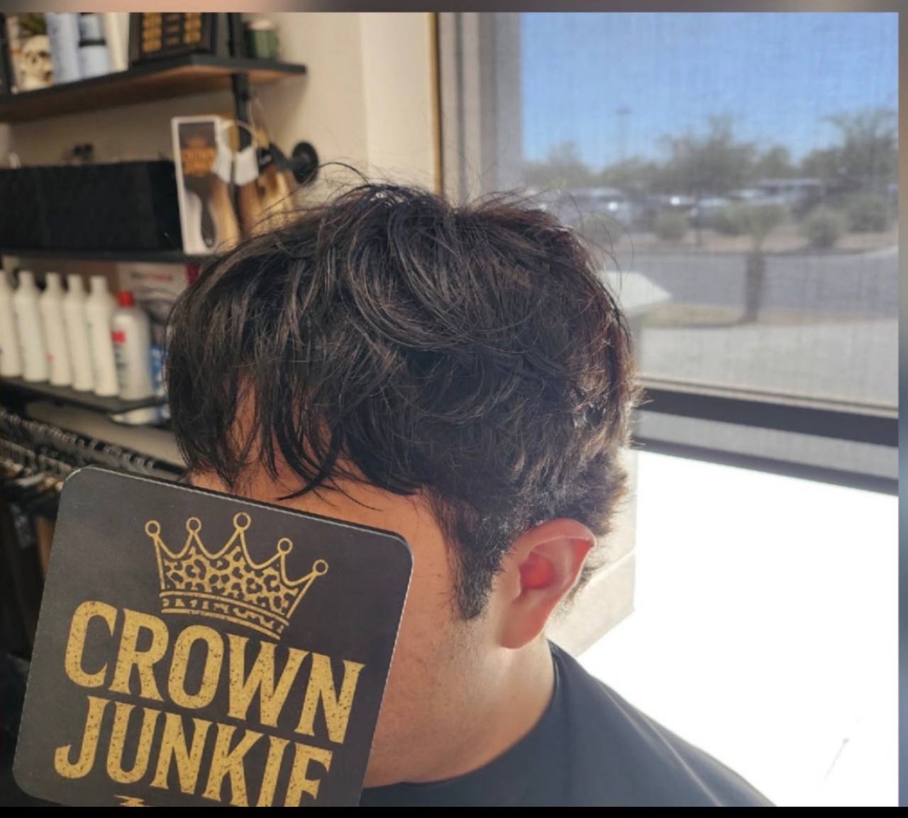 After — full natural men's hair replacement system